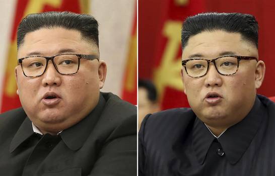 Kim Jong-Un adelgaza y desata especulaciones sobre su salud