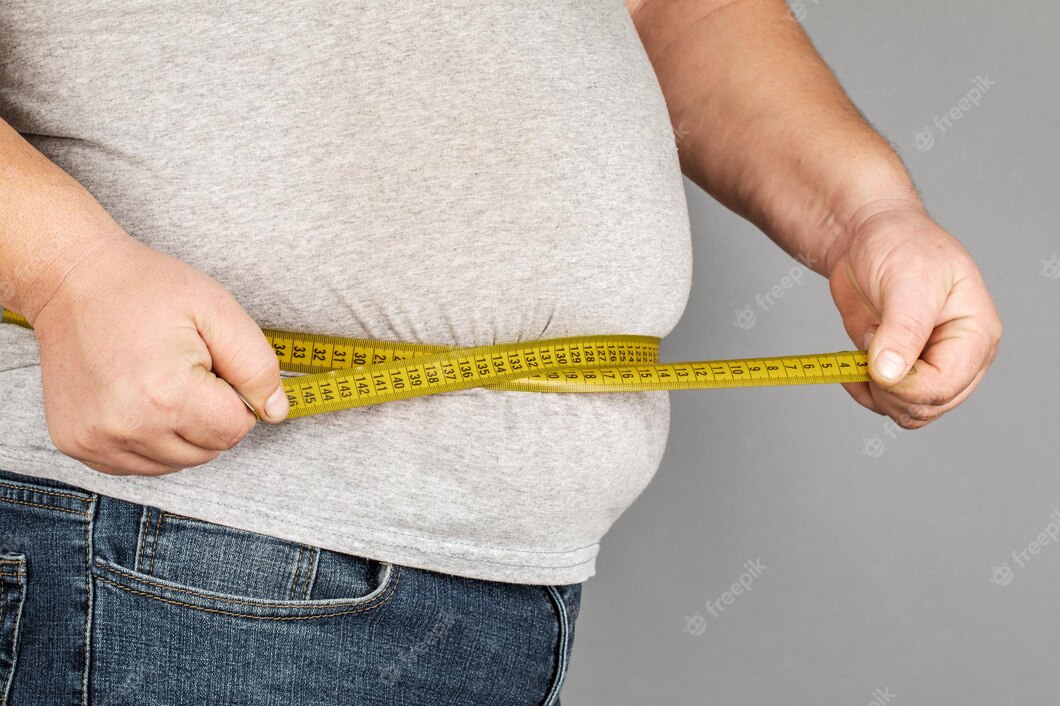 Población de Puerto Plata tiene 74% de obesidad y sobrepeso según estudio de Salud Pública