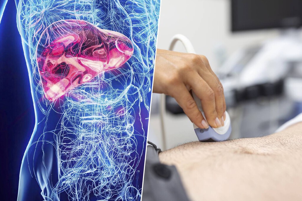 El hígado graso, una amenaza silenciosa que preocupa a la ciencia