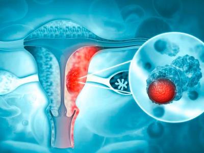 El cáncer es la principal causa de muerte entre los hispanos de EE. UU