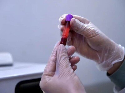 Estudio valida la sangre capilar para el control antidopaje