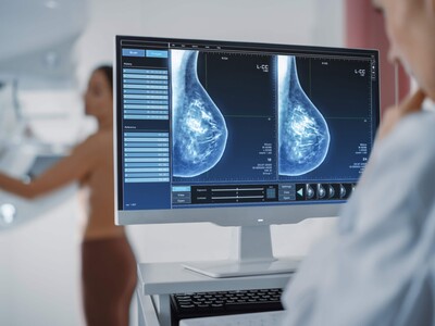 Mastóloga: «Más mujeres se curan del cáncer de mama»